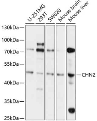 Western Blot: Chimaerin 2 Antibody [NBP2-92581] - Western blot analysis of extracts of various cell lines, using Chimaerin 2 antibody (NBP2-92581) at 1:1000 dilution. Secondary antibody: HRP Goat Anti-Rabbit IgG (H+L) at 1:10000 dilution. Lysates/proteins: 25ug per lane. Blocking buffer: 3% nonfat dry milk in TBST. Detection: ECL Basic Kit. Exposure time: 5s.